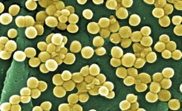 Eerste Belgische dode door superbacterie