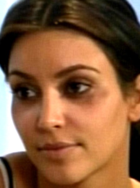 Blauw oog voor Kim Kardashian - Het Nieuwsblad
