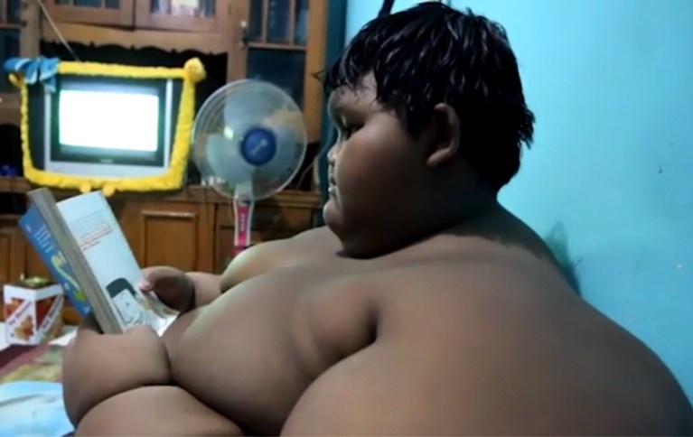 Jongen (10) weegt 192 kilogram: “Zo kan het niet langer”
