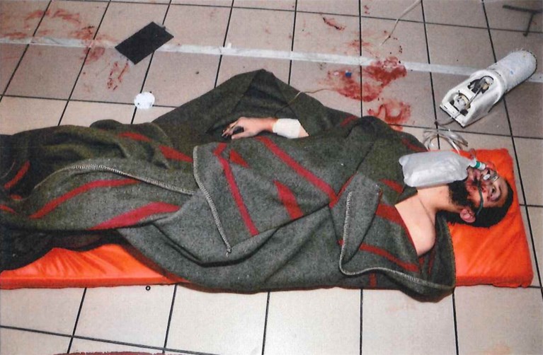 Salah Abdeslam onherkenbaar met opgezwollen gezicht op ...