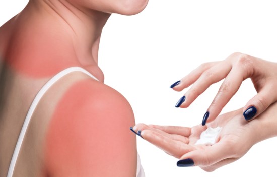 Verbrand In De Felle Zon Dit Is De Schade Aan Je Huid En Z Het Nieuwsblad Mobile