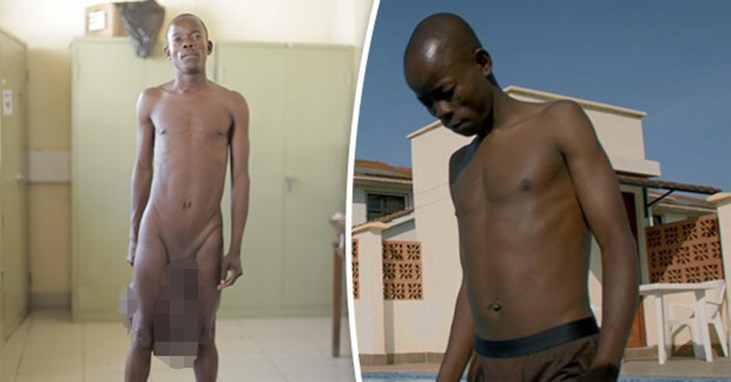 Man Met Balzak Van Maar Liefst 5 Kilogram Zwaar Krijgt Na 10 Het Nieuwsblad Mobile