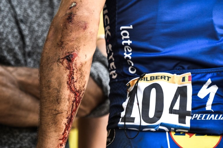 Einde Tour en gebroken knieschijf voor Philippe Gilbert na spectaculaire val: “Blij dat ik nog hier ben”
