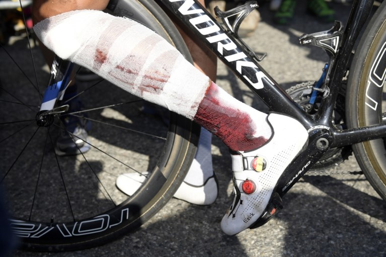 Einde Tour en gebroken knieschijf voor Philippe Gilbert na spectaculaire val: “Blij dat ik nog hier ben”