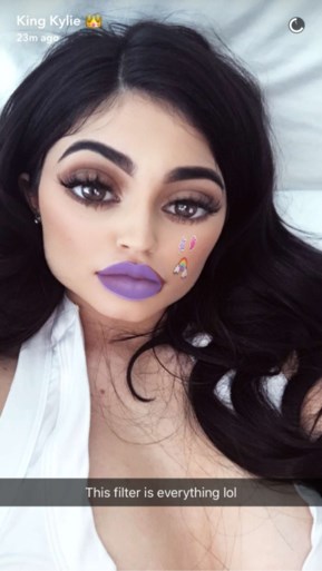 Verontrustende trend in de plastische chirurgie: “Steeds meer vraag naar Snapchat-gezicht”