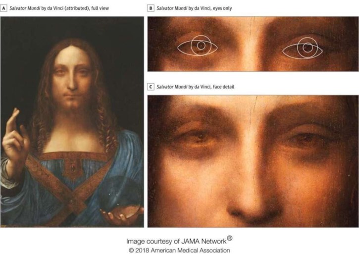 Wetenschappers ontdekken: de ziekte van Leonardo Da Vinci die zijn schilderijen nóg beter maakte