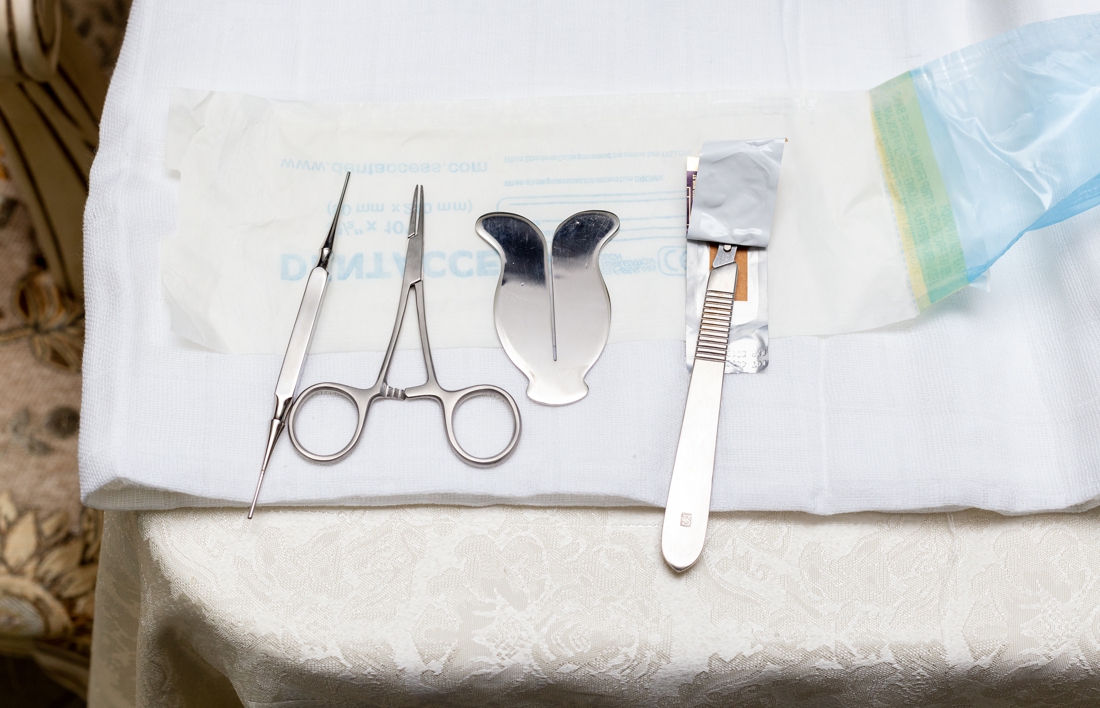 Besnijdenis tips na Gedeeltelijke Besnijdenis: