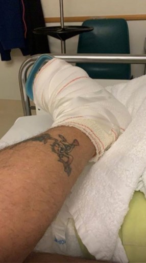 Stefan Everts toont foto na teenamputatie: “En toen waren ze nog met vier”