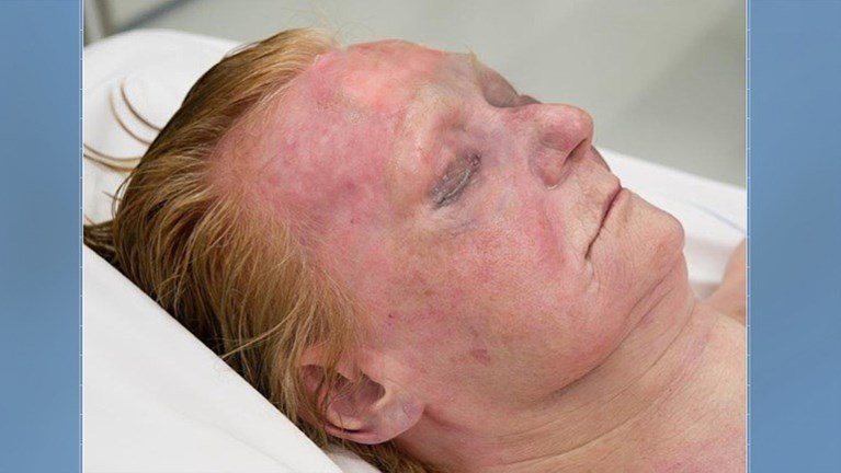 Nederlandse politie deelt foto’s van overleden (Belgische?) vrouw