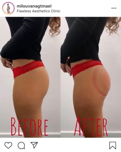 ‘Temptation’-Milou laat billen liften en toont het resultaat op Instagram