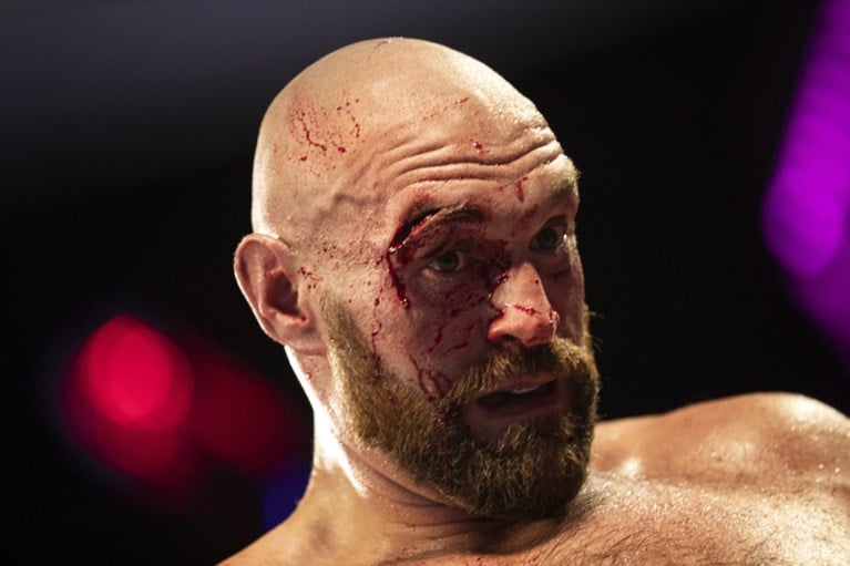 Aan het oog geraakte Tyson Fury moet zwoegen, maar klopt Otto Wallin op punten: “Dat bloed veranderde alles”