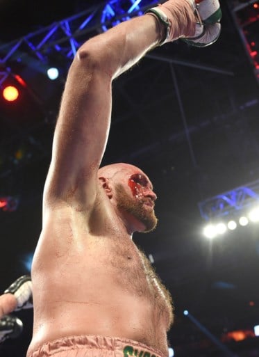 Aan het oog geraakte Tyson Fury moet zwoegen, maar klopt Otto Wallin op punten: “Dat bloed veranderde alles”
