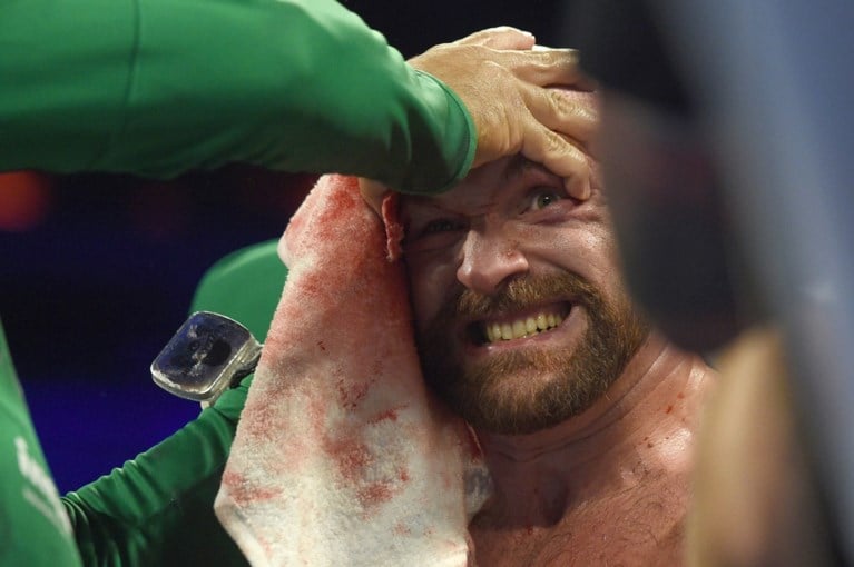 Aan het oog geraakte Tyson Fury moet zwoegen, maar klopt Otto Wallin op punten: “Dat bloed veranderde alles”