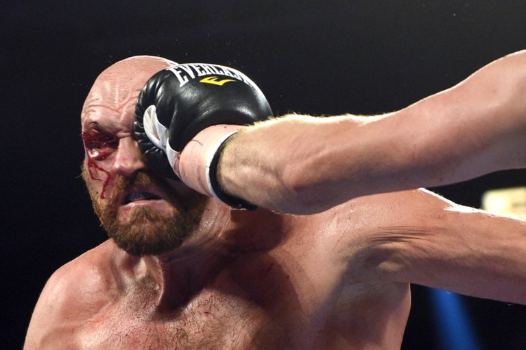 Aan het oog geraakte Tyson Fury moet zwoegen, maar klopt Otto Wallin op punten: “Dat bloed veranderde alles”