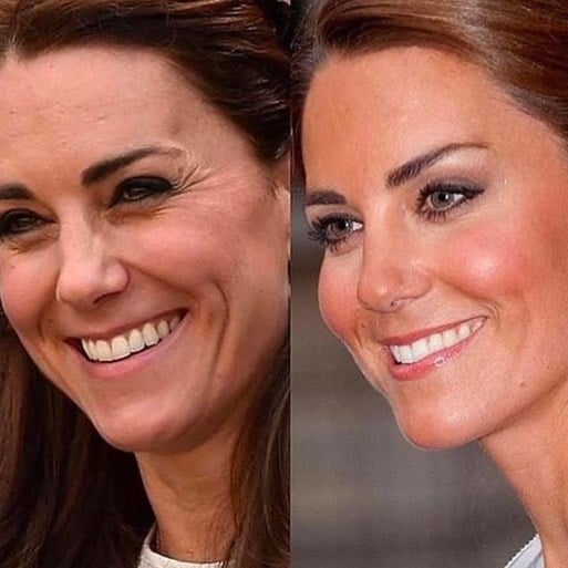 Brits koningshuis “furieus” nadat kliniek voor plastische chirurgie foto van Kate Middleton misbruikt