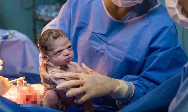 Vader inleveren Koken Baby'tje wordt geboren, maar is allesbehalve onder de indruk van de wereld  | Het Nieuwsblad Mobile