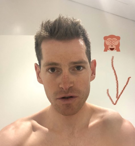 Ben Hermans moet nog een tweede schouderoperatie ondergaan, tien weken na zijn zware val in Tour Down Under