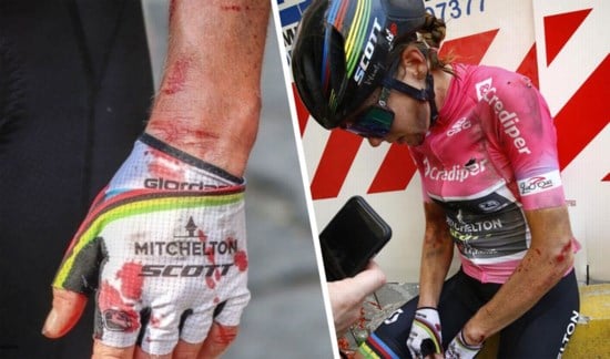 pix Annemiek Van Vleuten Accident annemiek van vleuten ziet na stomme