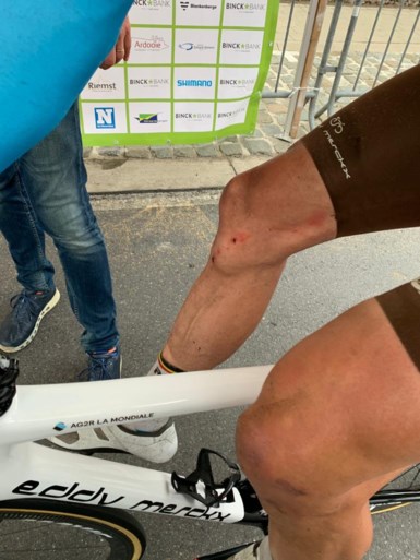 Zorgen voor Oliver Naesen na zware valpartij: “Ik vrees voor een voetbalblessure”