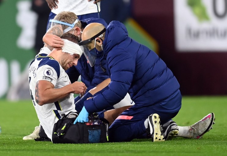 Toby Alderweireld niet zonder kopzorgen naar Antwerpen: verdediger loopt hoofdwonde op in match tegen Burnley