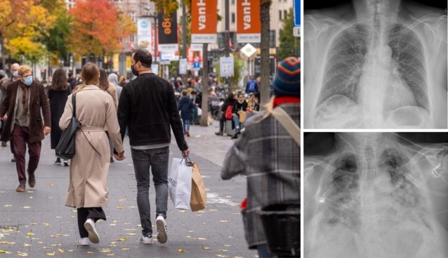 Dokter waarschuwt mensen voor ernstige gevolgen van winkelen op koopzondag: “Hoe het begon. Hoe het eindigde”