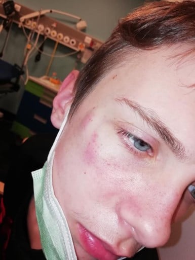 Kylian (14) krijgt voor schooltijd rake klappen van andere leerlingen: “Je krijgt schrik om je kinderen naar school te laten gaan”