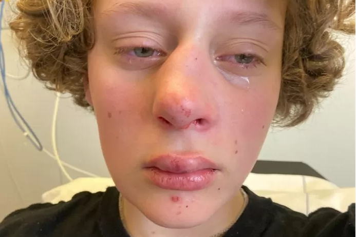 Heel Nederland steunt Frédérique die mishandeld werd omdat ze niet wou zeggen of ze jongen of meisje was: “Ik zou niet gedurfd hebben wat zij deed”