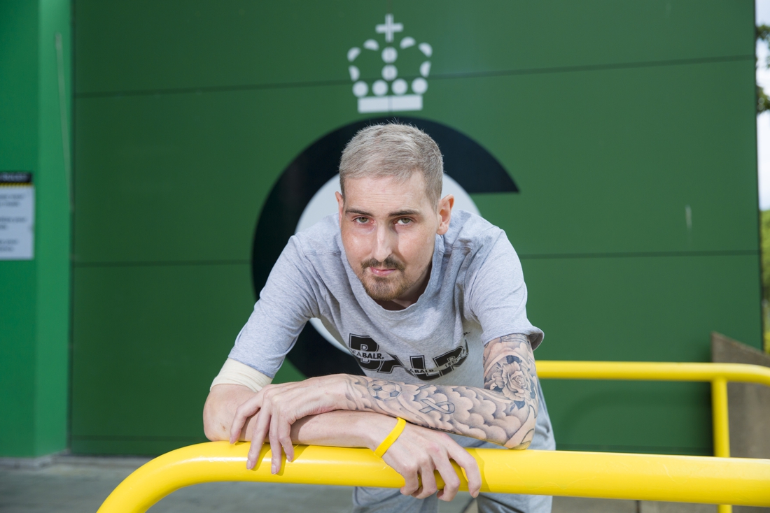 Verschrikkelijk nieuws voor Cercle-doelman Miguel Van Damme: opnieuw kankercellen aangetroffen in bloed