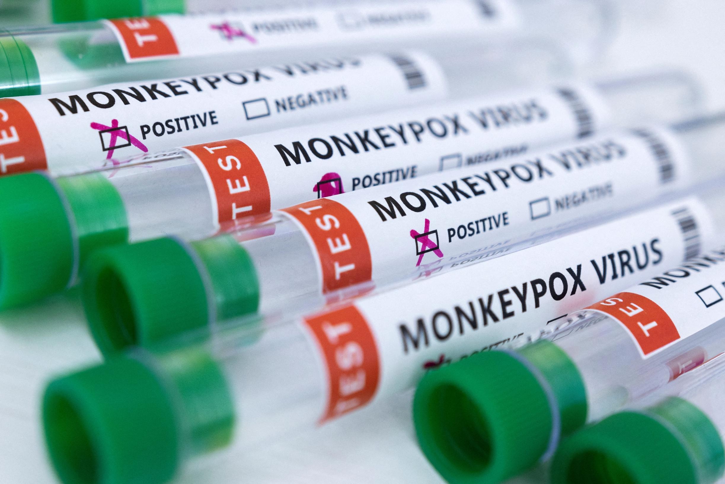 Monkeypox outbreak in Europe has been going on since mid-April, WHO says