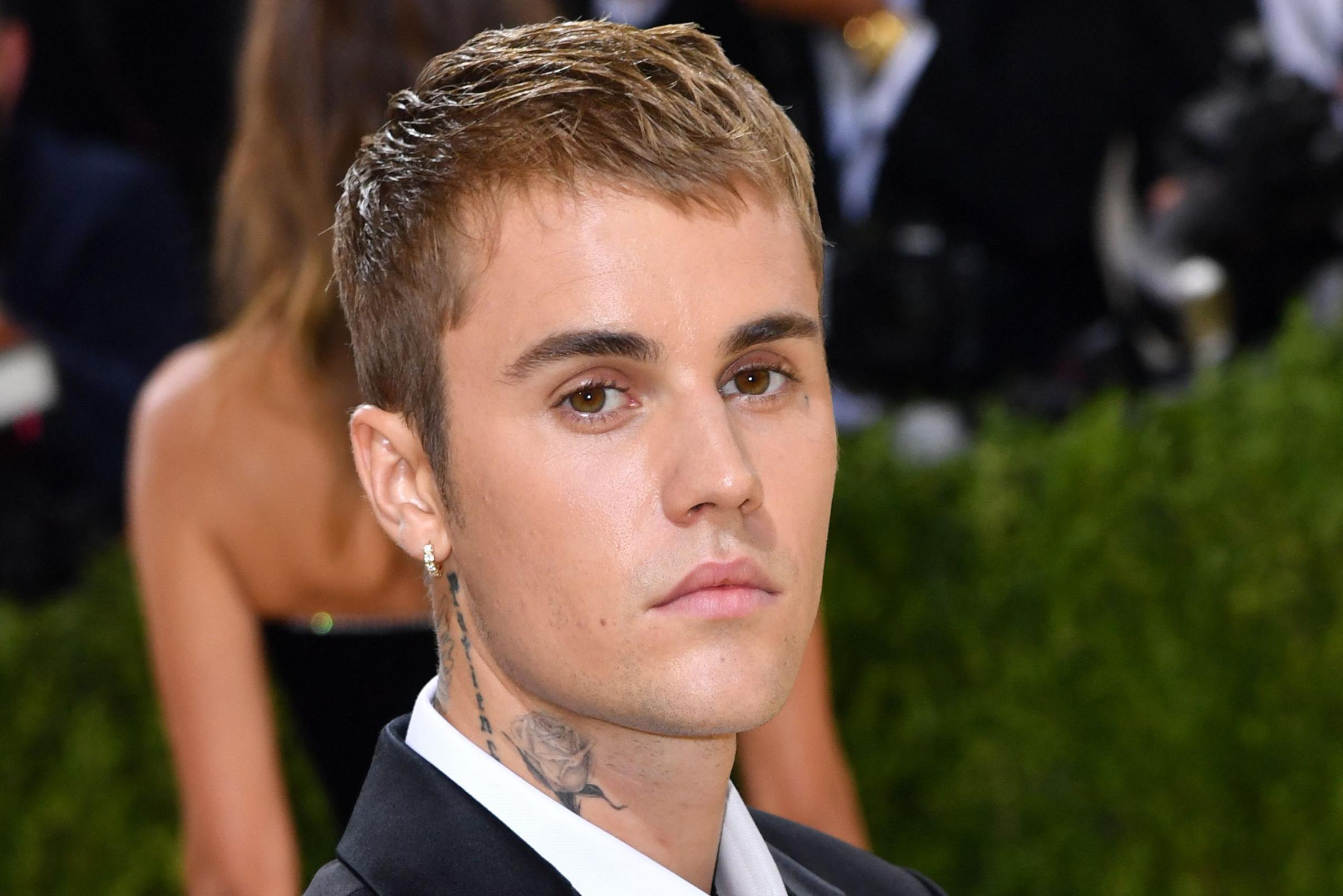 Justin Bieber hervat tournee na verlamming gezicht | Het Nieuwsblad Mobile