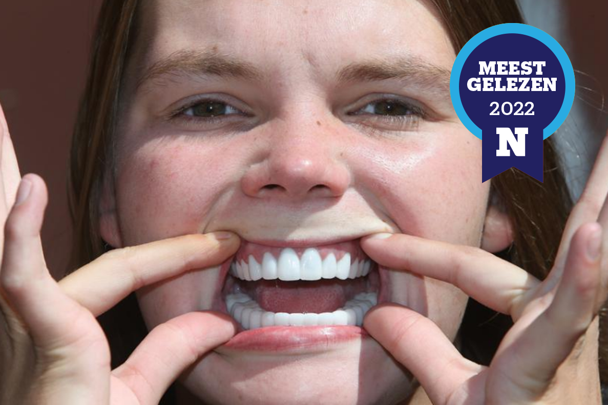Discipline Een hekel hebben aan De waarheid vertellen Alana (23) reisde naar Turkije voor een nieuw gebit: “Ik kreeg mooie  tanden, maar toen begon mijn nachtmerrie” (Gavere) | Het Nieuwsblad Mobile