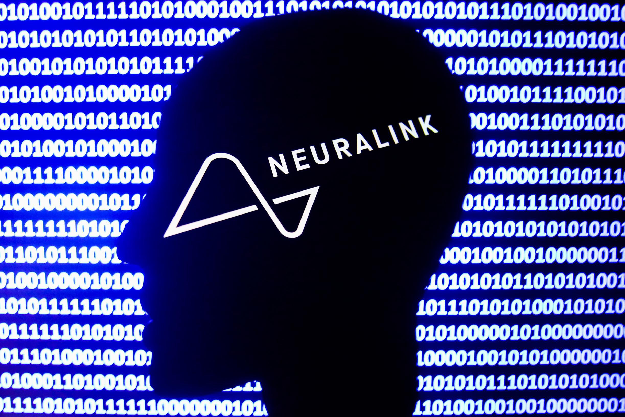 Musk’s company wants approval for revolutionary brain implants within six months