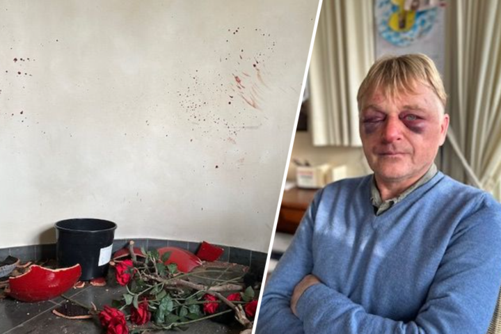 Jan (56) bont en blauw geslagen tijdens brutale overval bij hem thuis: “Hij herhaalde wel tien keer dat hij mij zou doden”