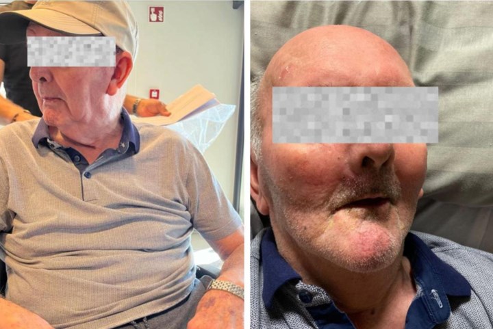 Familie van ex-bewoner over schrijnende toestanden in rusthuis: “Doorligwonde zo groot als een tennisbal en geur van urine”