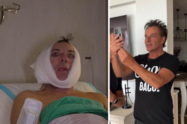 Na facelift Gerard Joling: “Mijn gezichtsherkenning op gsm werkt niet meer”
