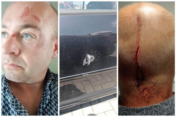 Dimitri (46) werd slachtoffer van extreme verkeersagressie, dader kent zijn straf: “Mijn zoontje is nog altijd onder de indruk als hij een ambulance ziet”