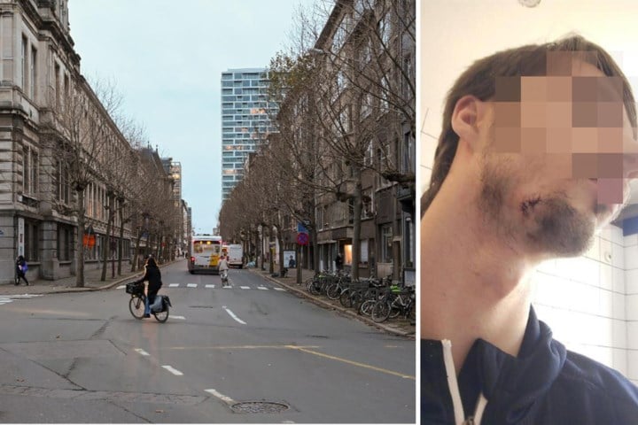 “Zonder aanleiding sloeg hij met stuk glas in m’n gezicht”: Luka (17) uit Wijnegem was een van de drie slachtoffers van man die met hamer en fles uithaalde